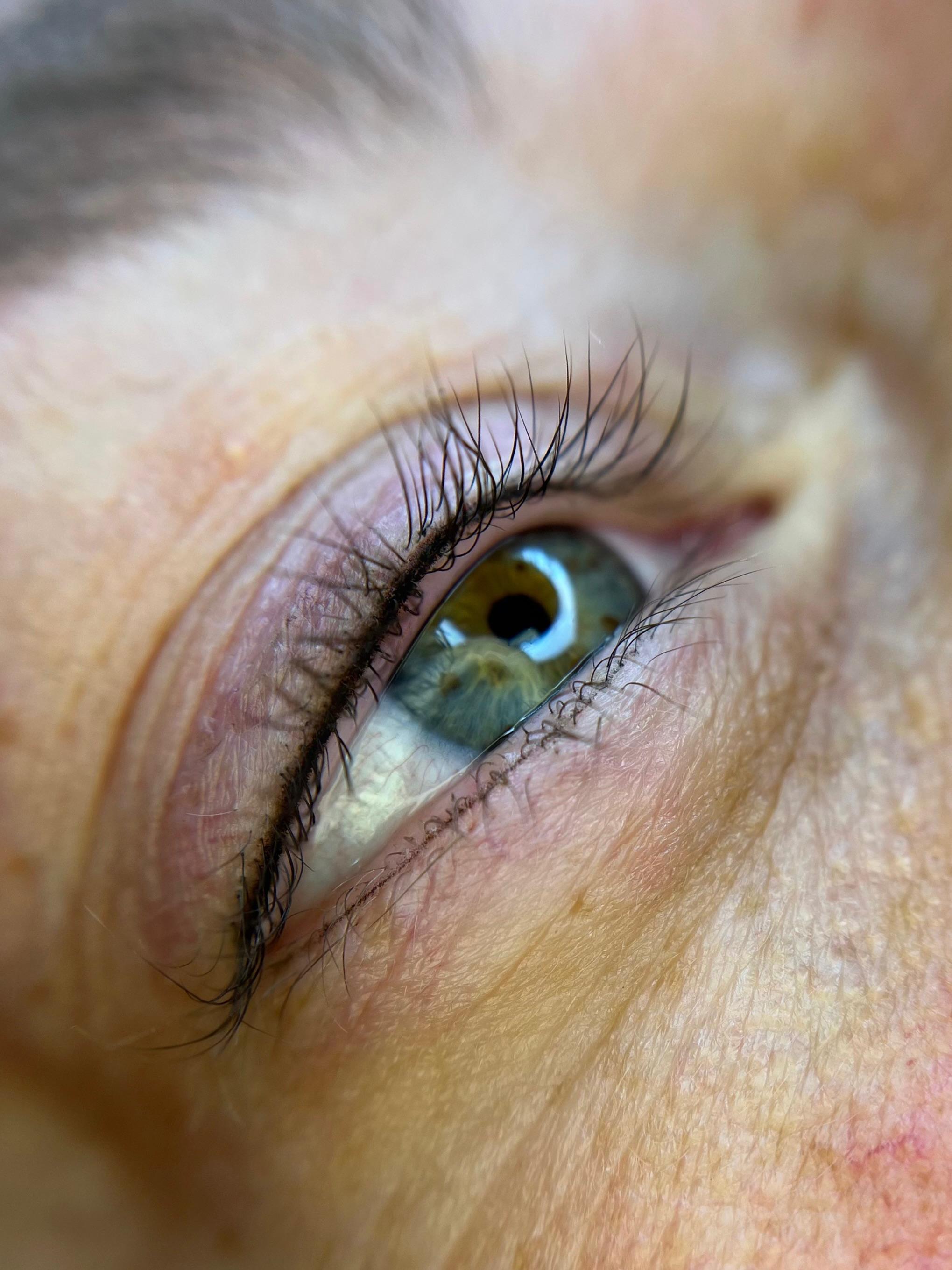 Deepliner onder nazorg